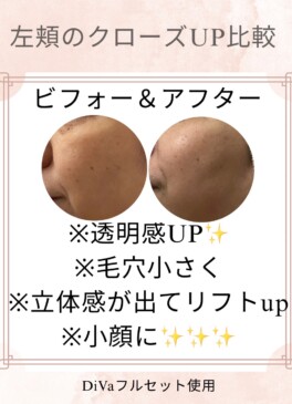 症例2-2