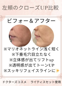 症例3-3