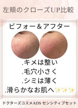 症例1