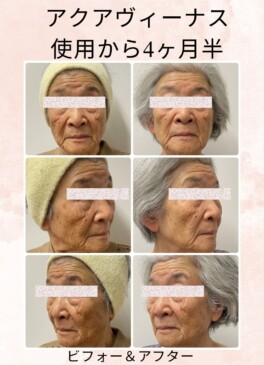 症例4-2