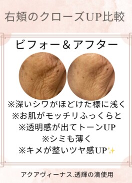 症例4-1